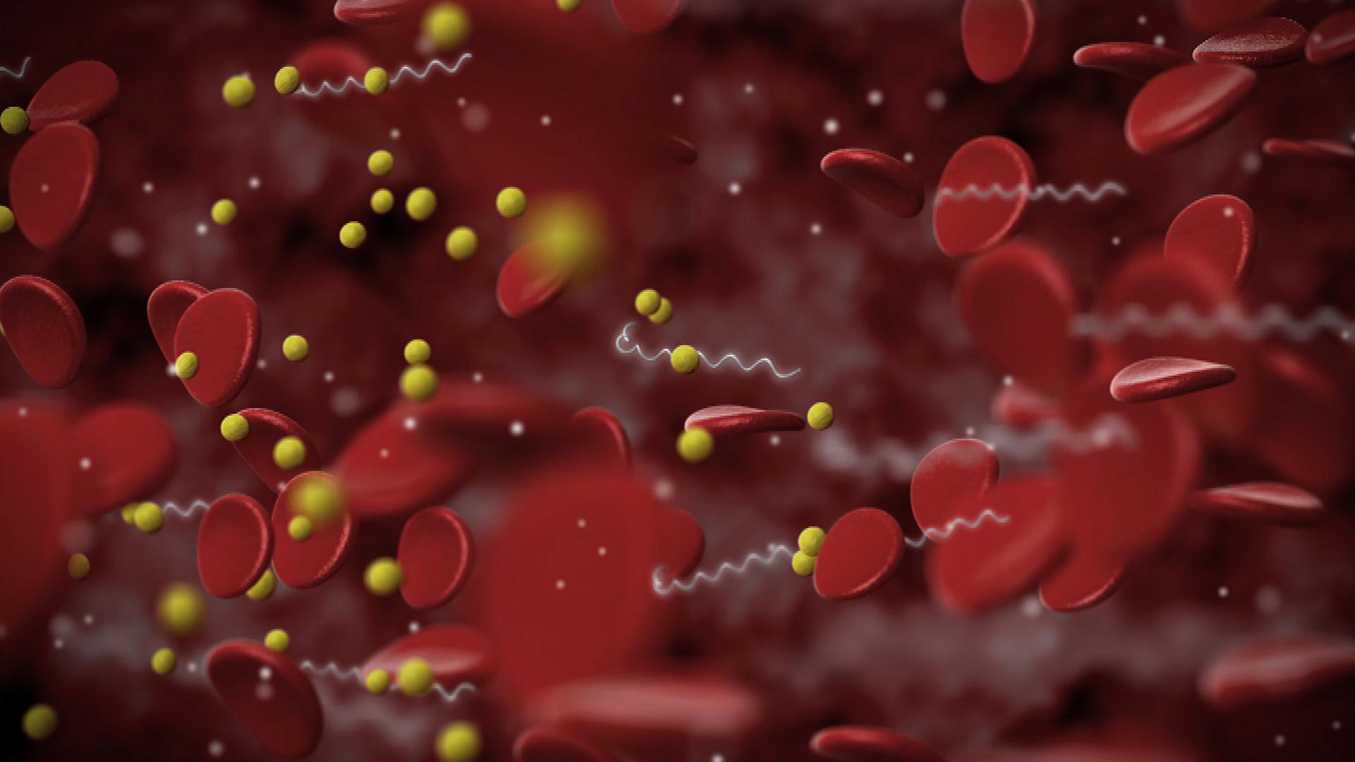 Тайна болезни Лайма (tajna-bolezni-lajma) Документальный фильм