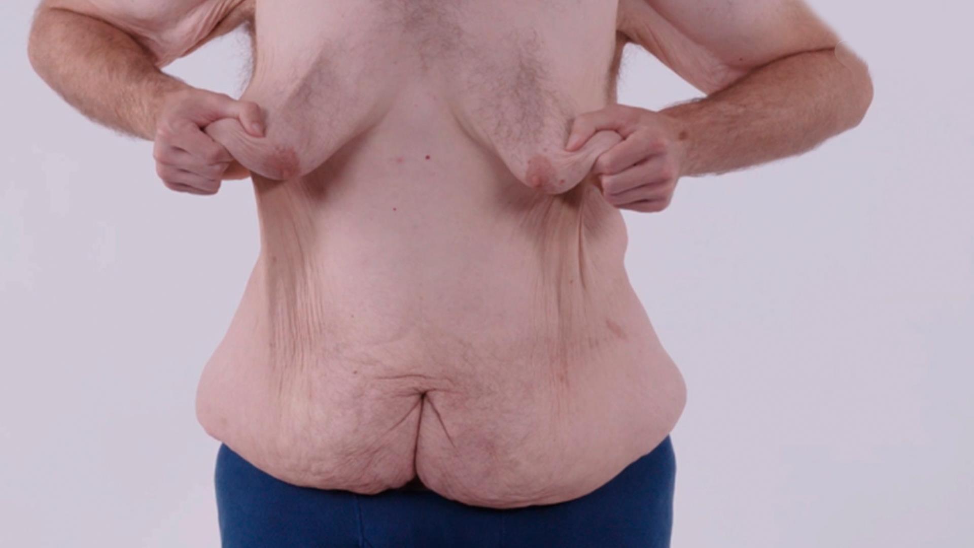 Лишняя кожа (lishnjaja-kozha) Документальный сериал