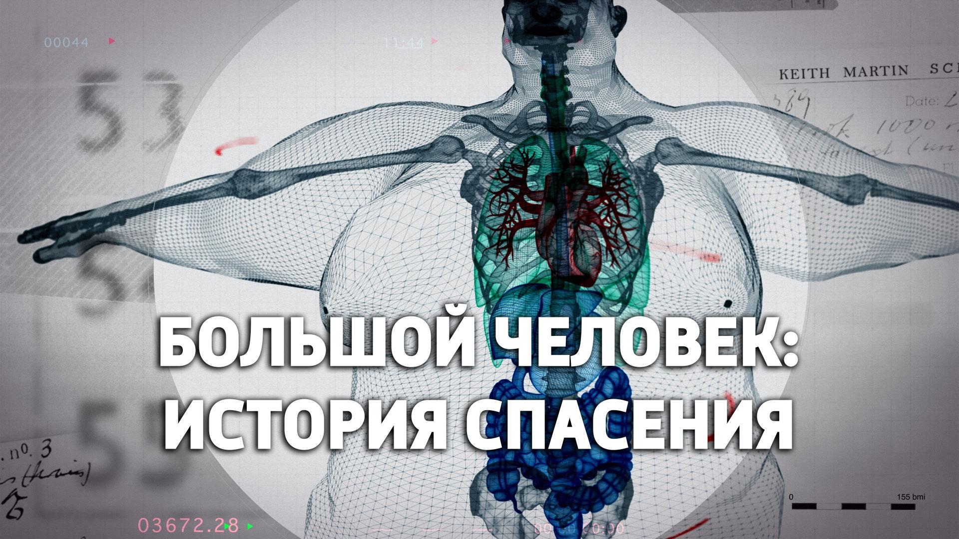 Большой человек: история спасения (bolshoj-chelovek-istorija-spasenija) Документальный фильм