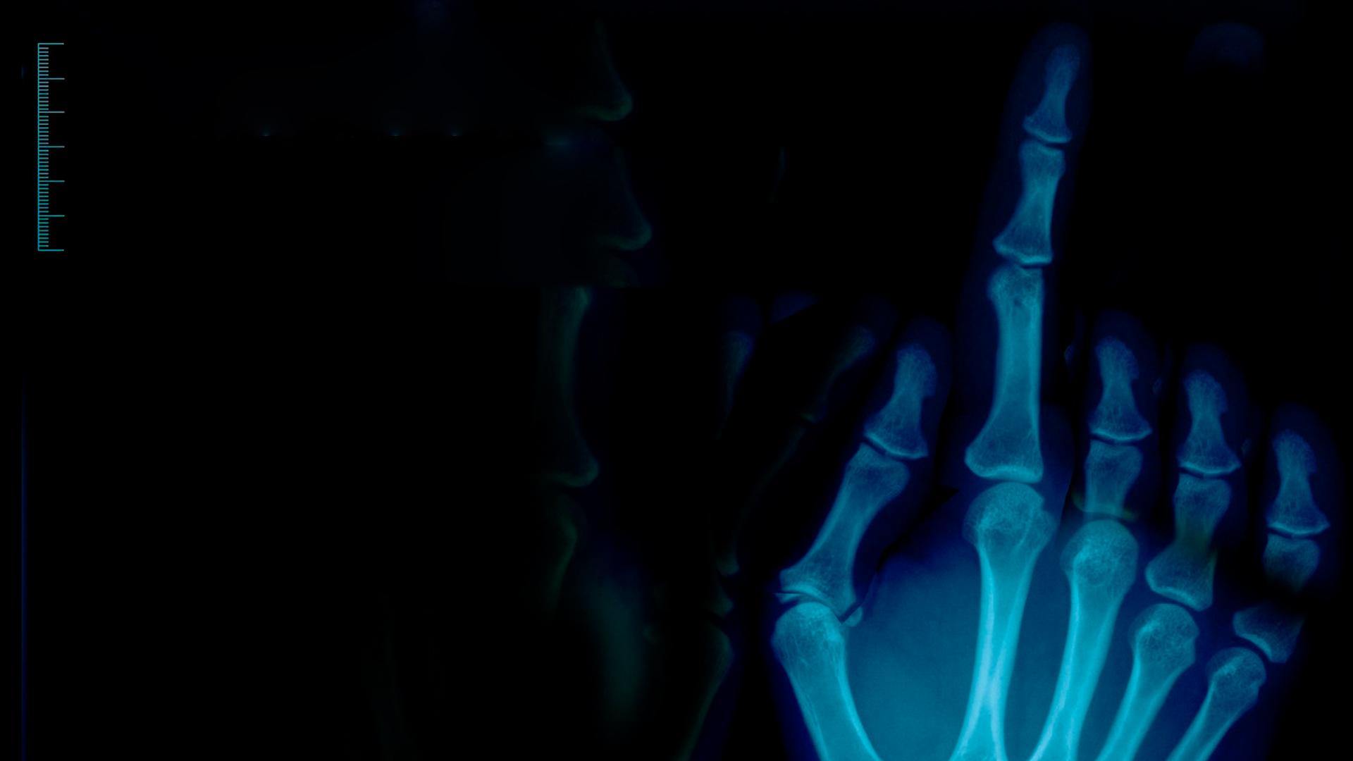 Диагноз: живые или мёртвые (diagnoz-zhivye-ili-mertvye) Документальный сериал