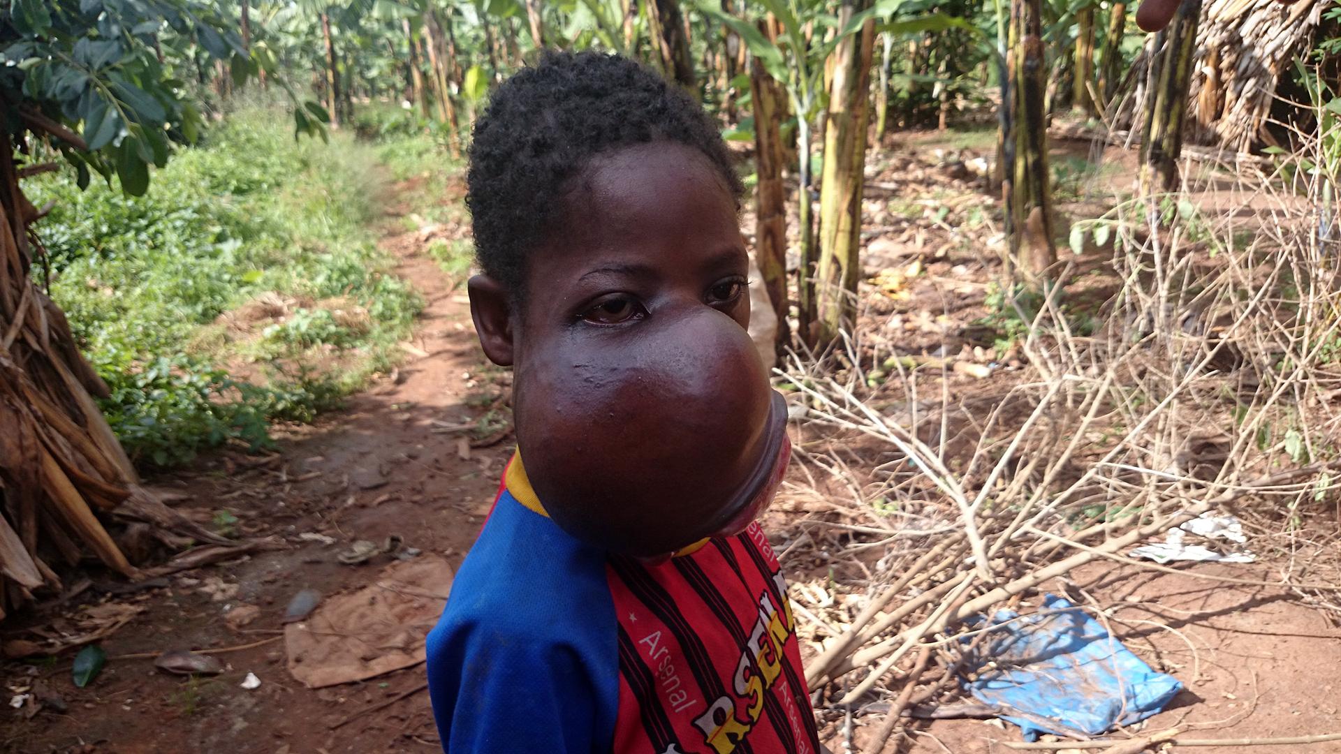 Эрик: Мальчик без лица (erik-malchik-bez-litsa) Документальный фильм