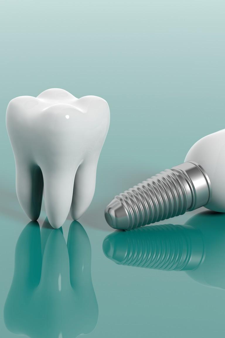 Smile Healthy Los Angeles: Discover a long-term dental solution with ClearChoice Dental Implant Centers (smile-healthy-los-angeles-discover-a-long-term-dental-solution-with-clearchoice-dental-implant-centers) Досуг, хобби