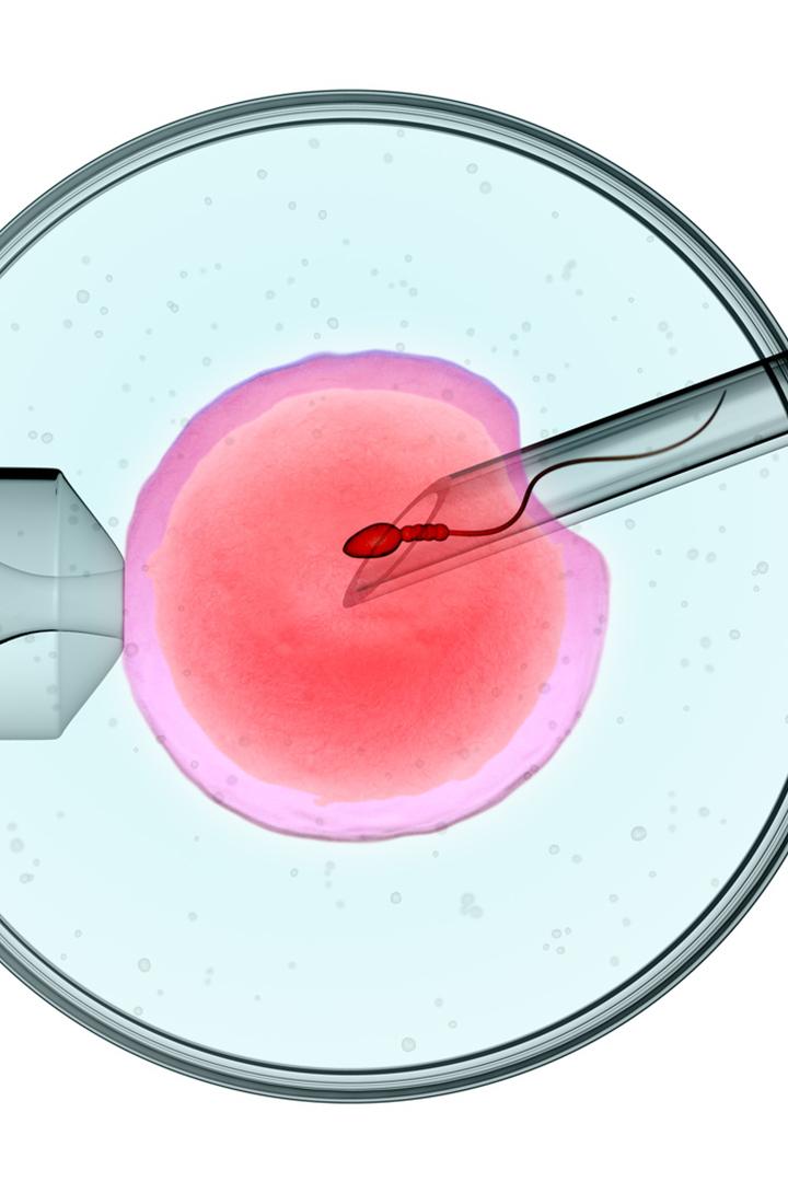 In vitro. Nauka czy cud (in-vitro-nauka-czy-cud) Документальный фильм