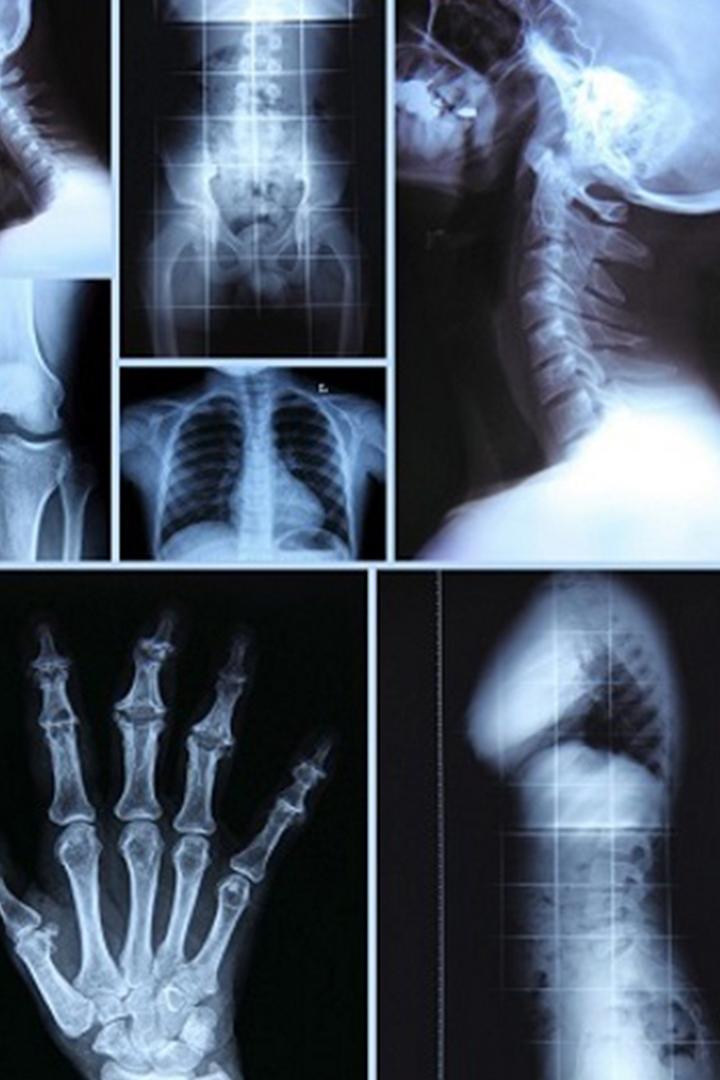 Будущее у лучевой диагностики (buduschee-u-luchevoj-diagnostiki) Познавательное