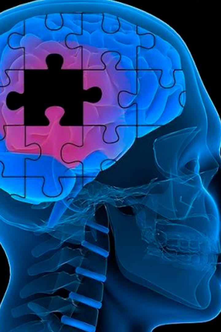 Когнитивные нарушения: диагностика, лечение и профилактика (kognitivnye-narushenija-diagnostika-lechenie-i-profilaktika) Познавательное