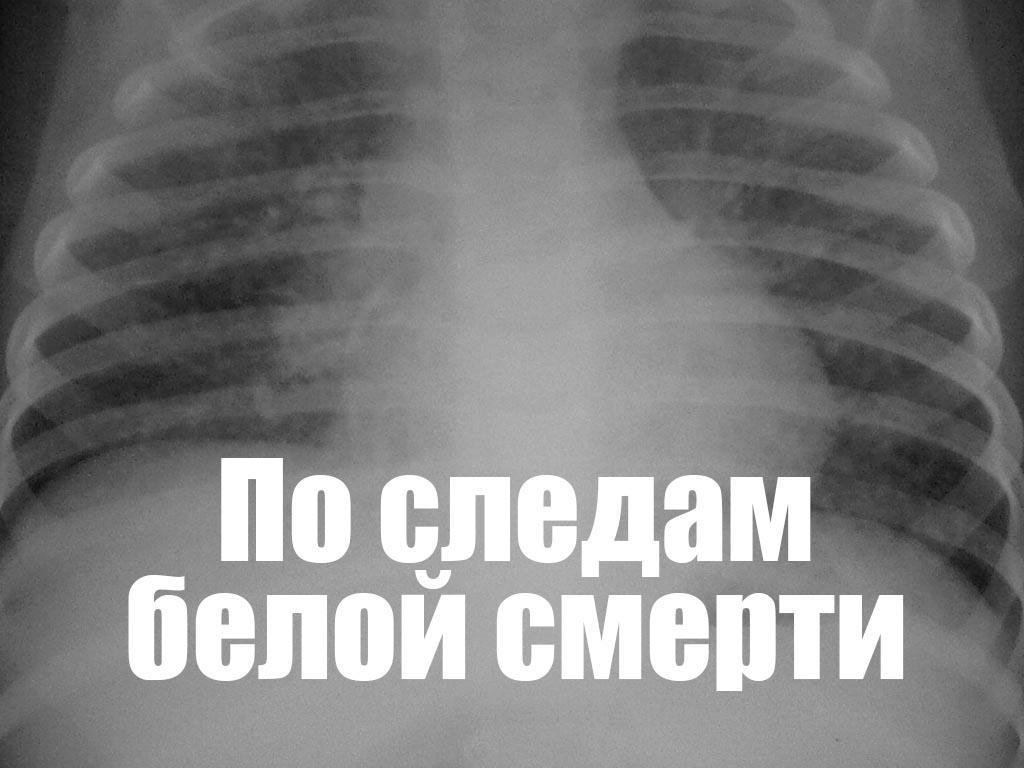 По следам белой смерти (po-sledam-beloj-smerti) Документальный фильм