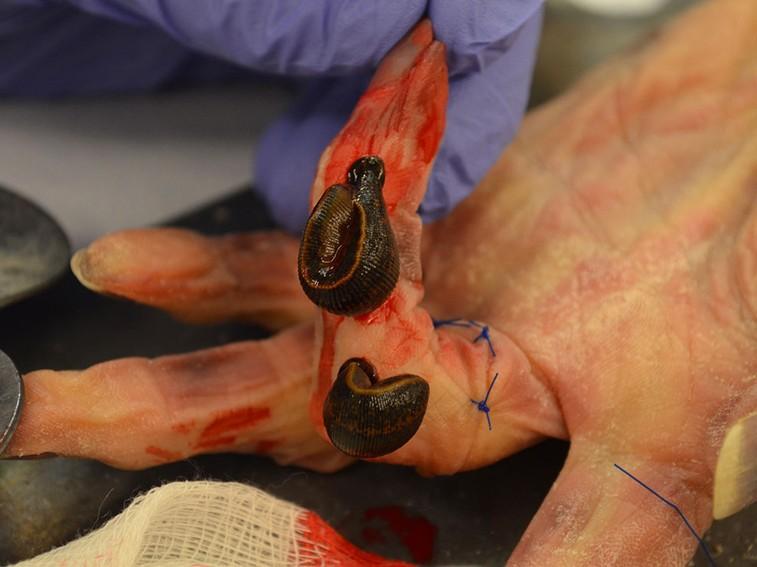 Самые странные в мире: ползучие целители (samye-strannye-v-mire-polzuchie-tseliteli) Документальный фильм