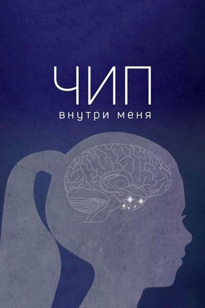 Чип внутри меня (chip-vnutri-menja) Документальный фильм