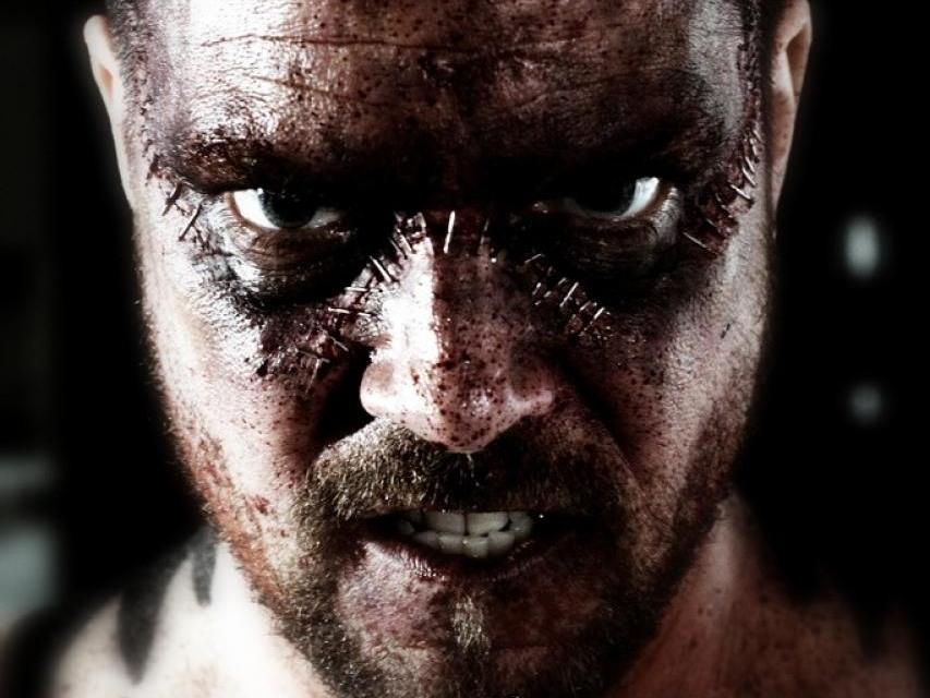 Синдром Франкенштейна (sindrom-frankenshtejna) Фильм 2010