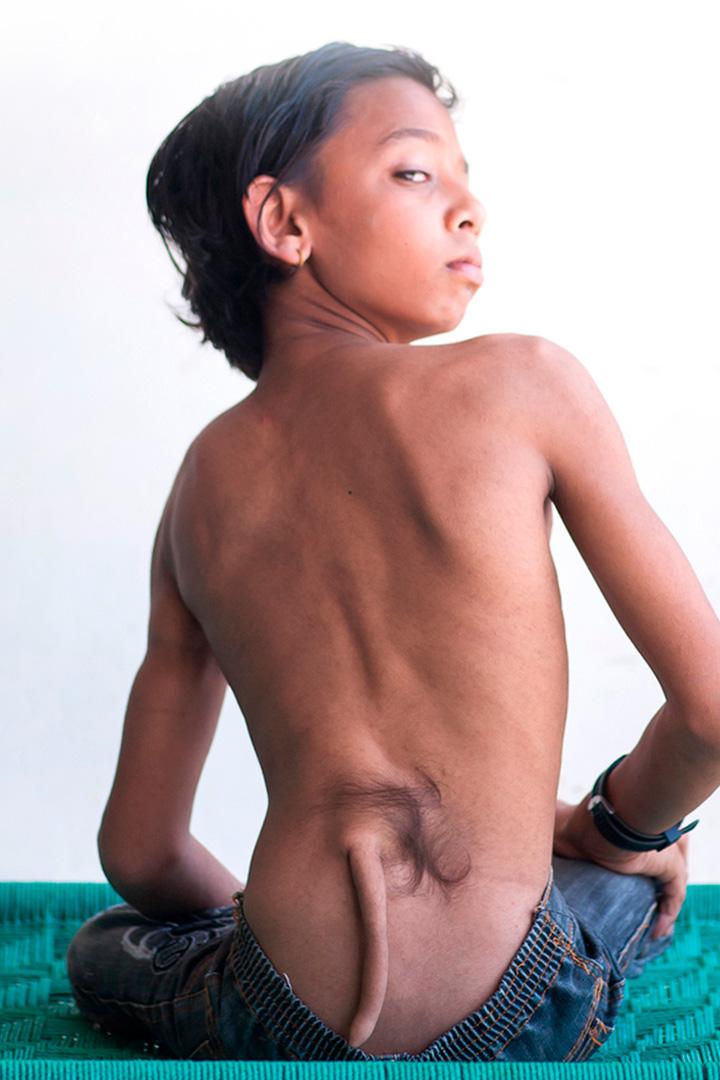 Worst Disease You've Never Heard Of: Body Bizarre (worst-disease-youve-never-heard-of-body-bizarre) Познавательное