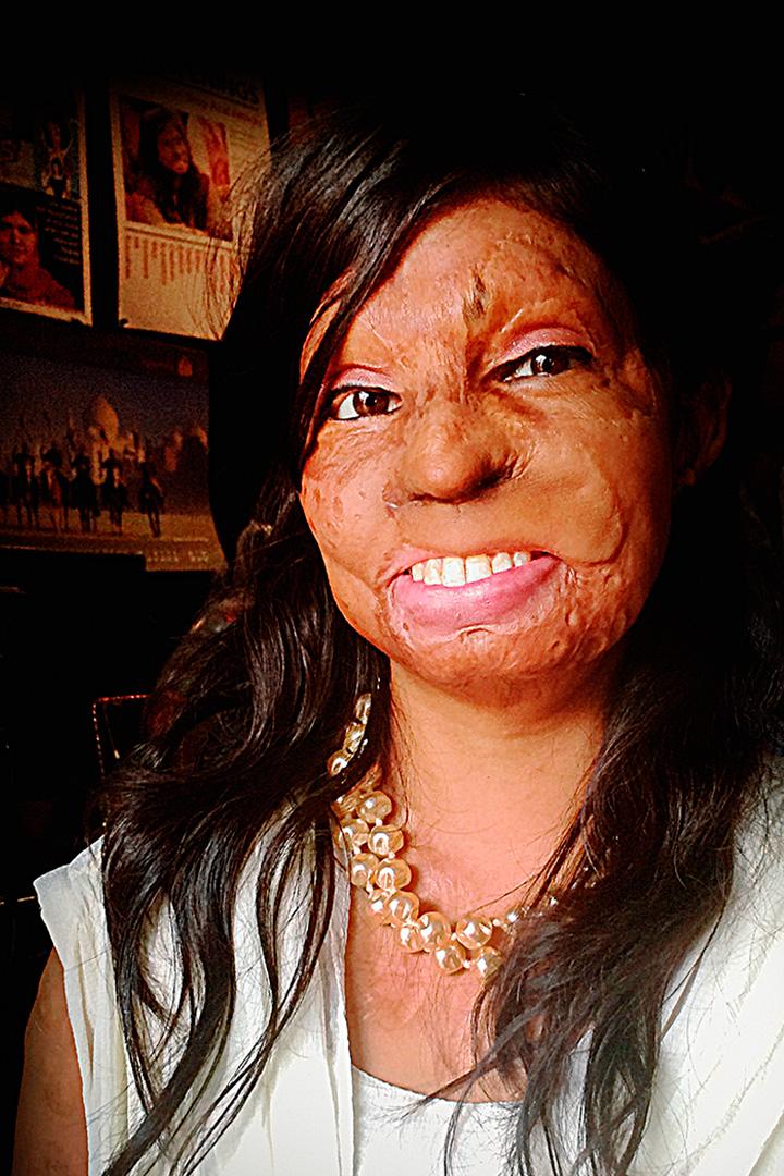 Украденная красота (ukradennaja-krasota) Документальный фильм